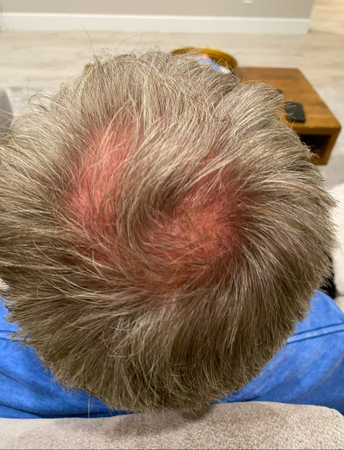 OMS Leave In, Anti-Aging/Hair Rejuvenation Serum