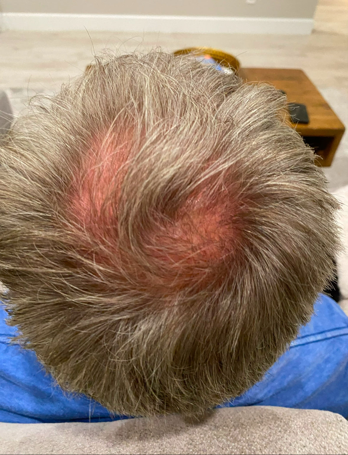 OMS Leave In, Anti-Aging/Hair Rejuvenation Serum