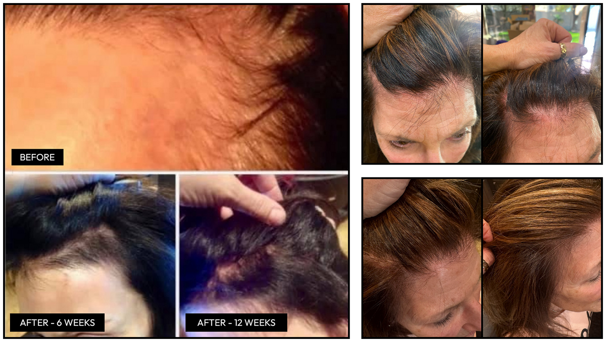 Duo Bundle: Ultimate Day &amp; Night Hair Rejuvenation 2 Month Supply